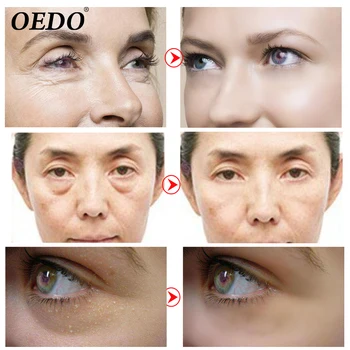 20PCS el Cuidado de la Piel Eterna Anti Arrugas Anti-Envejecimiento de Oro de Cristal de la Máscara de Ojo del Colágeno de Reparación Círculo Oscuro Anti-Hinchazón de los Ojos de Blanqueamiento
